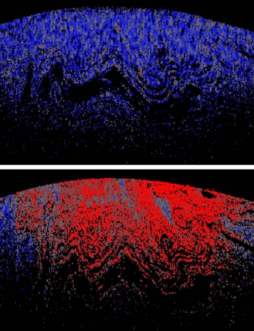 Spatially-resolved volume monitoring of adhesive cure using correlated-image optical coherence tomography