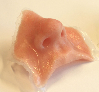 soft tissue facial prostheses
