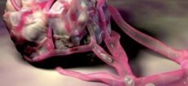 Live-Cell Imaging of Invasion and Intravasation in an Artificial Microvessel Platform