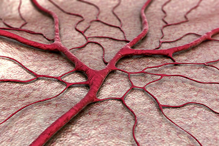 blood vessel scarrning