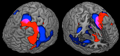 A Model-Free De-Drifting Approach for Detecting BOLD Activities in fMRI Data-	- Advances in Engineering