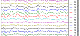 EEG predictors of covert vigilant attention. Advances in Engineering