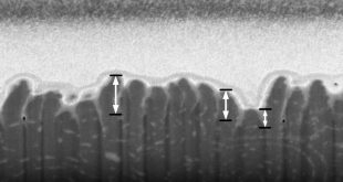 Femtosecond laser-induced nanostructures for improving performance of medical implants-Advances in Engineering