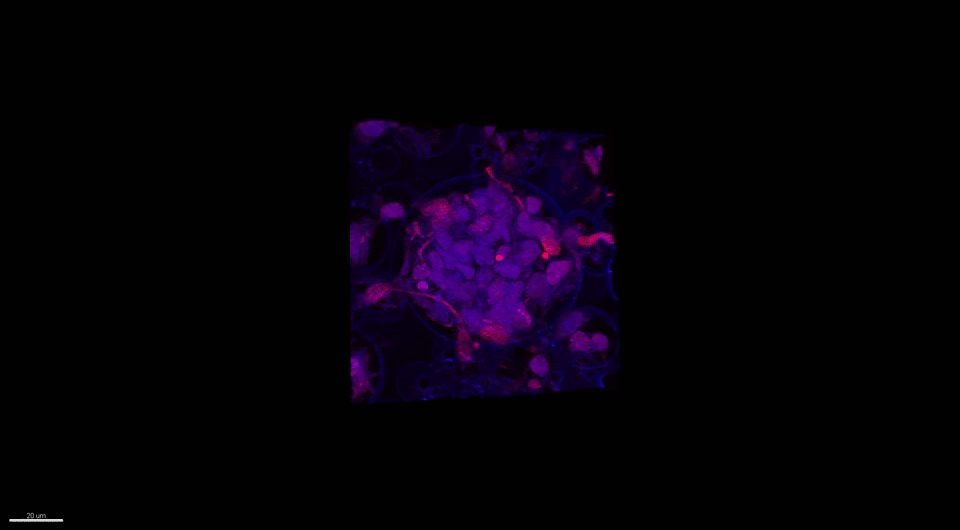 Three-dimensional stem cell-derived neural culture using porous polymer scaffolds - Advances in Engineering
