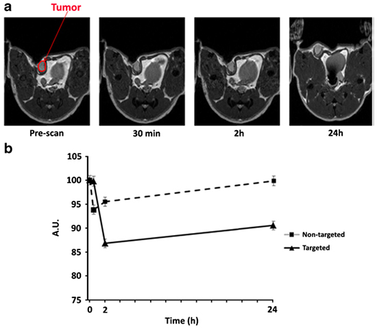 Scientists develop a novel LYP-1 targeted iron oxide nanoparticle for early detection of triple negative breast cancer - Advances in Engineering Scientists develop a novel LYP-1 targeted iron oxide nanoparticle for early detection of triple negative breast cancer - Advances in Engineering