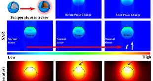 Optical phase change nanomaterial: A promising candidate for photothermal therapy - Advances in Engineering