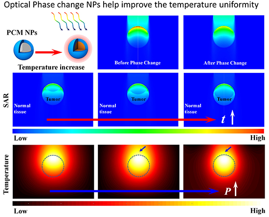 Optical phase change nanomaterial: A promising candidate for photothermal therapy - Advances in Engineering