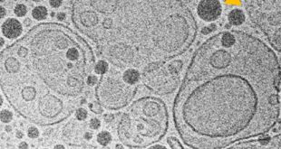 Combining surfactant vesicles, silicone oil and biopolymers in a fabric softener formulation - Advances in Engineering