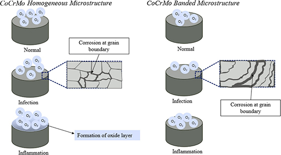 Microstructure Matters: Corrosion Vulnerability of CoCrMo Alloys in Simulated Biological Environments - Advances in Engineering Microstructure Matters: Corrosion Vulnerability of CoCrMo Alloys in Simulated Biological Environments - Advances in Engineering